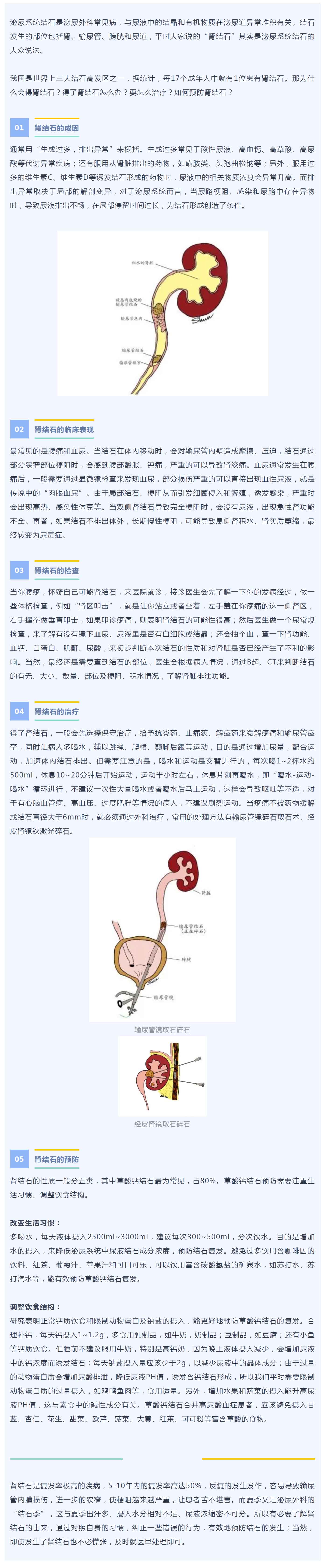 为什么会得肾结石？得了肾结石怎么办？跟着专家来解惑→ 副本.jpg